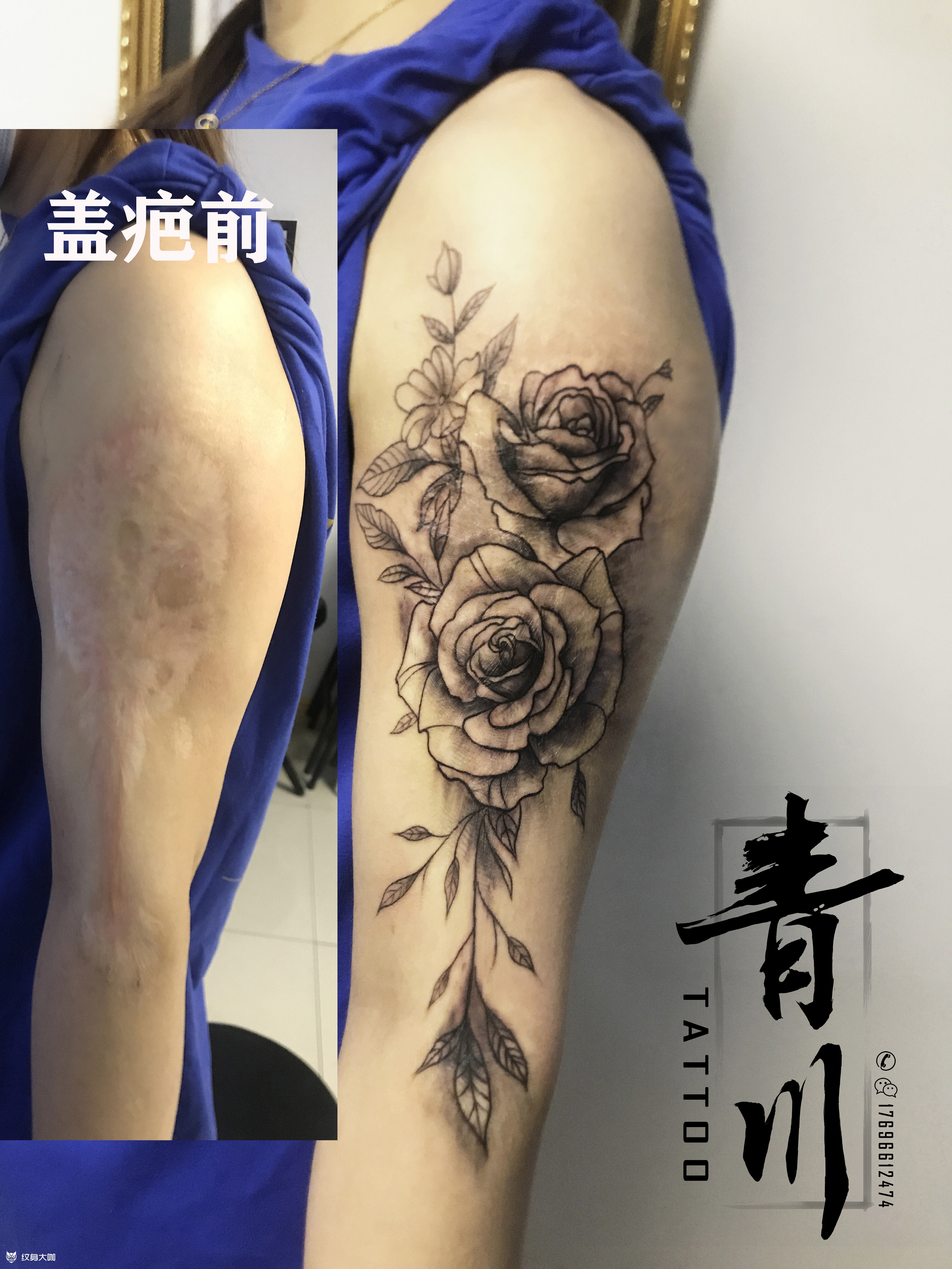 遮盖烫伤疤_纹身图案手稿图片_申思的纹身作品集