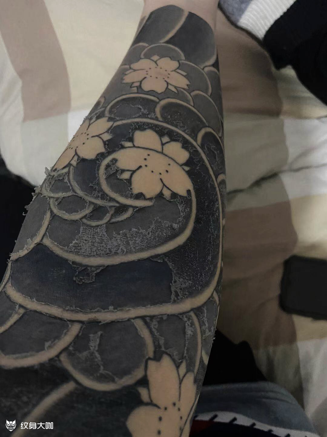 樱花臂恢复中未完成
