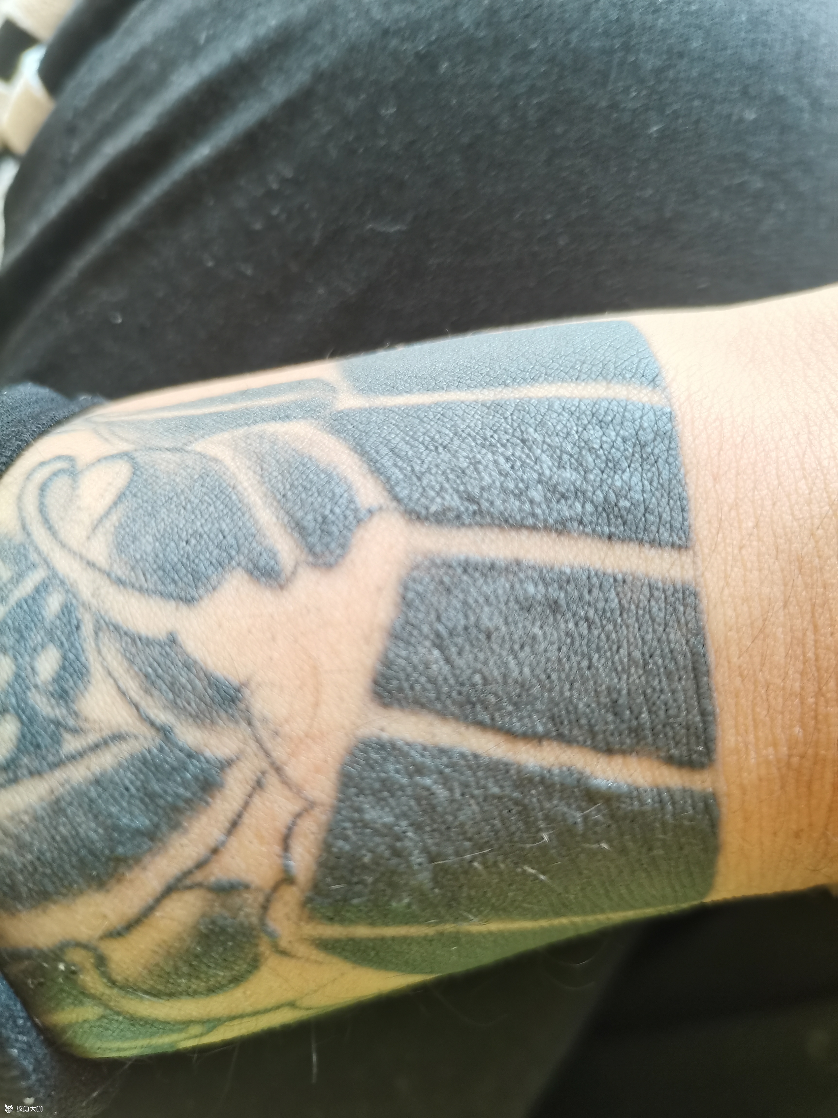 这是排异还是怎么了,几个月复发_纹身吧社区 - 纹身大咖