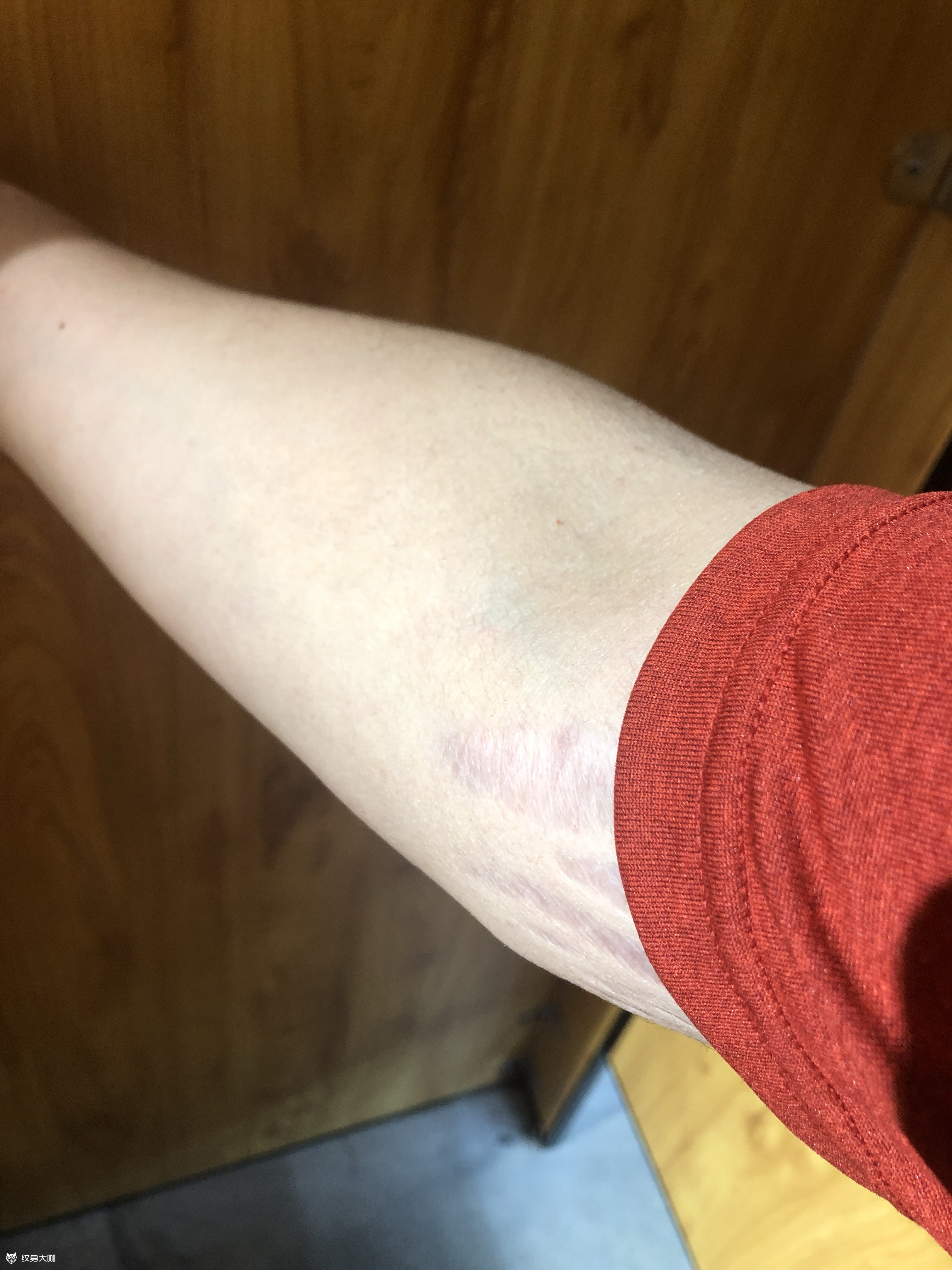 左右上臂内侧,肥胖_纹身吧社区 - 纹身大咖