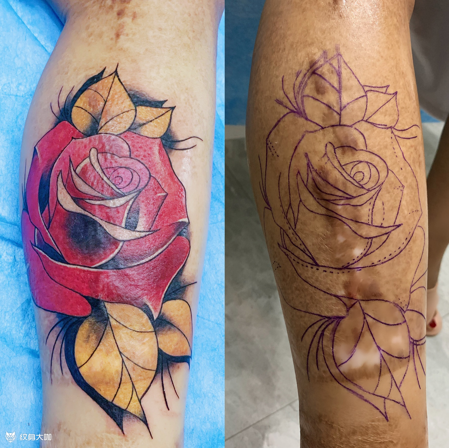 腿部遮疤_纹身图案手稿图片_付丽亚的纹身作品集