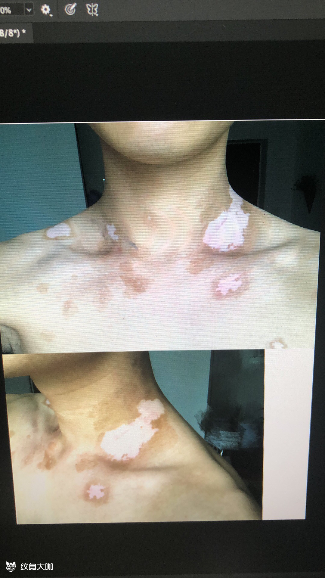 白斑盖图_纹身吧社区 - 纹身大咖