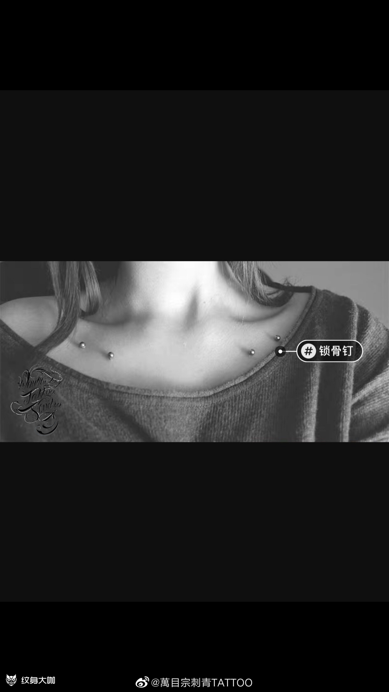 穿孔埋钉锁骨钉