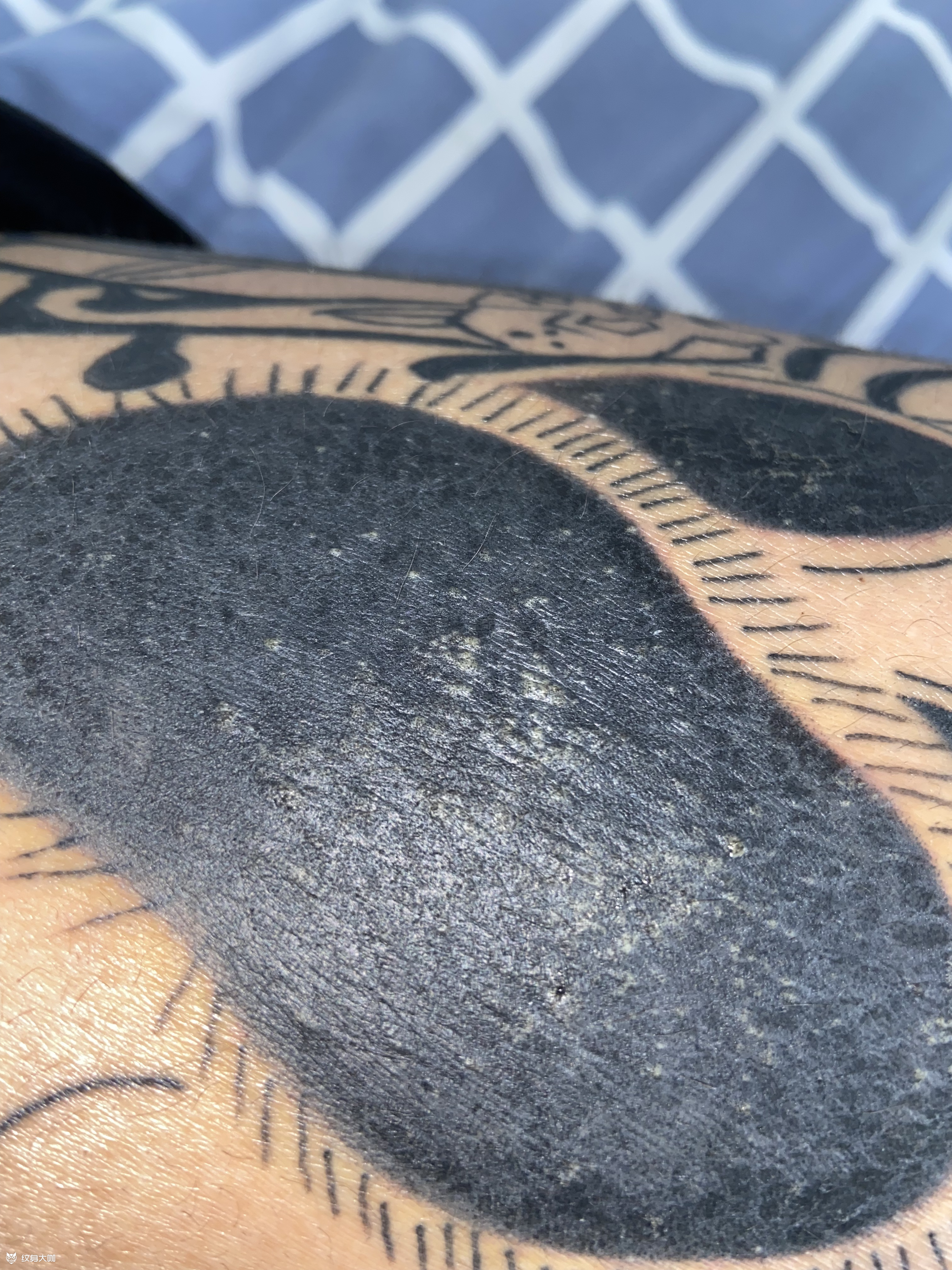 4条评论写评论柠橘6月25日 17点排异 吃点药就好了艾加纹身6月25日 17