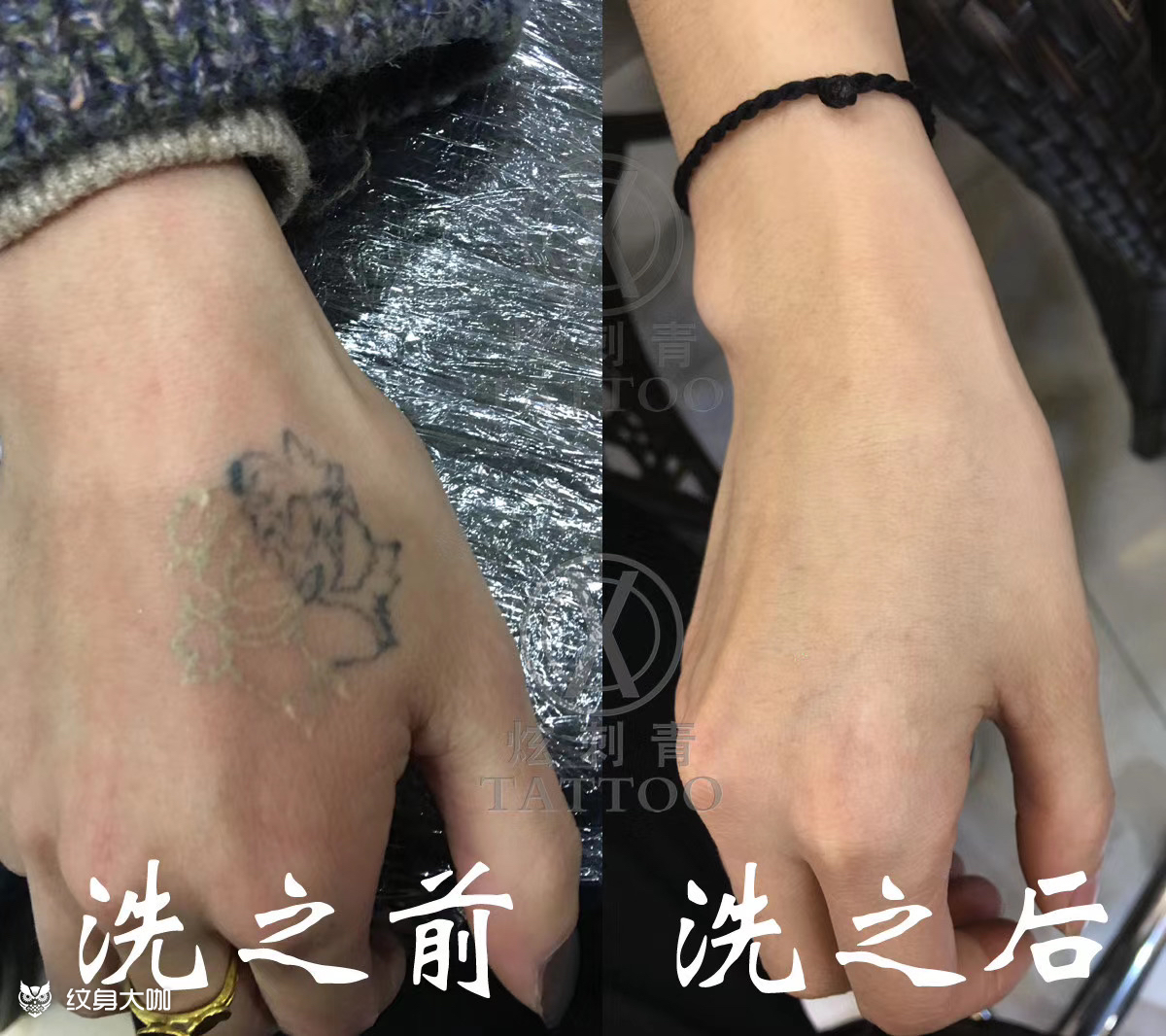 洗纹身对比效果图_纹身图案手稿图片_阿飞的纹身作品集