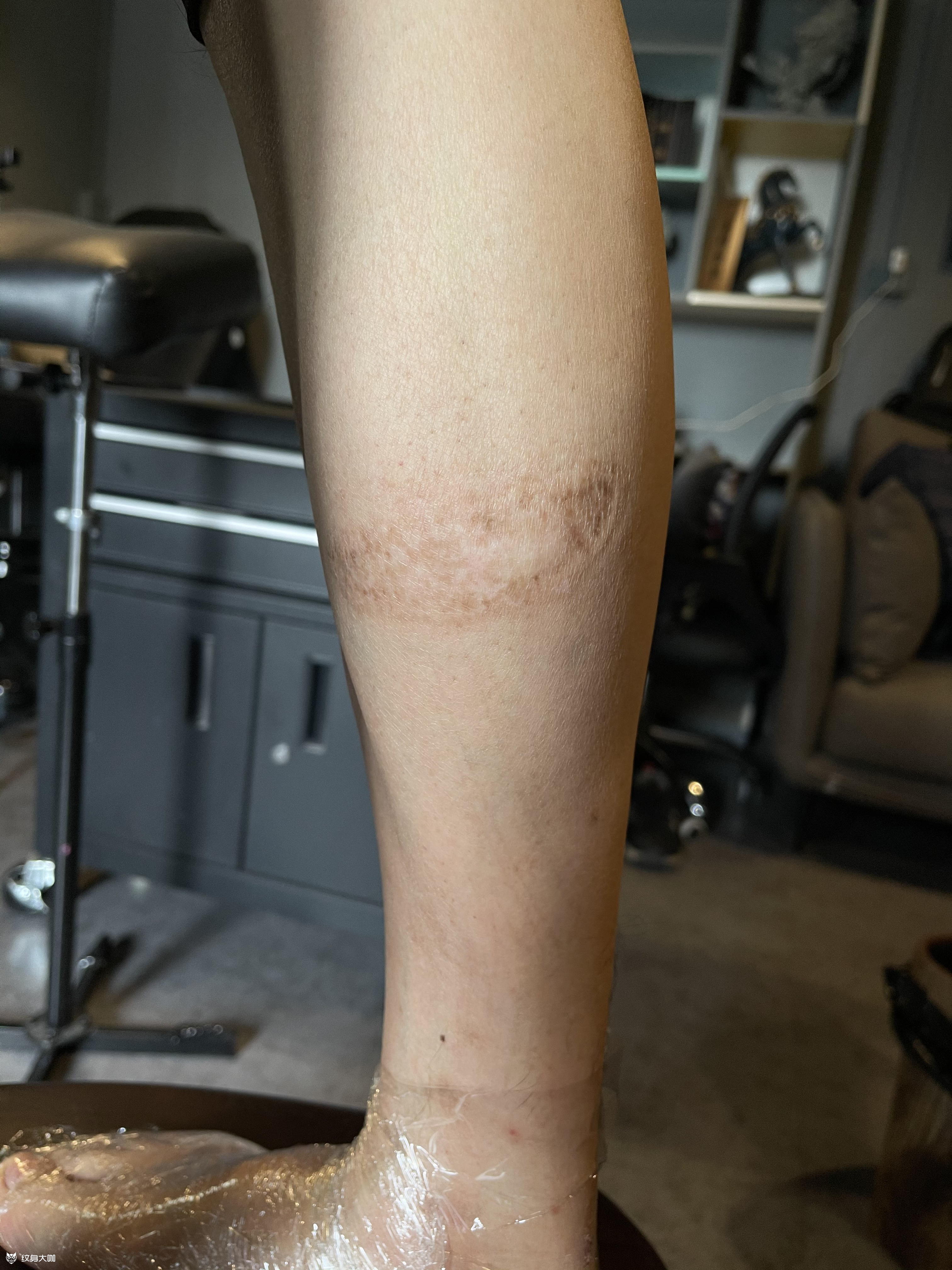 疤痕遮盖_纹身图案手稿图片_壹升的纹身作品集