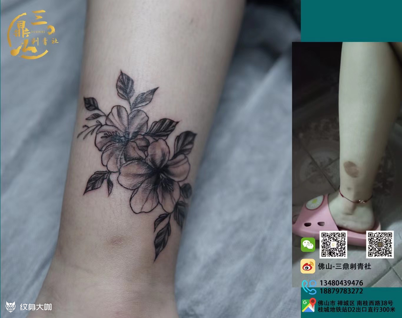 小腿疤痕遮盖_纹身图案手稿图片_赖赖的纹身作品集