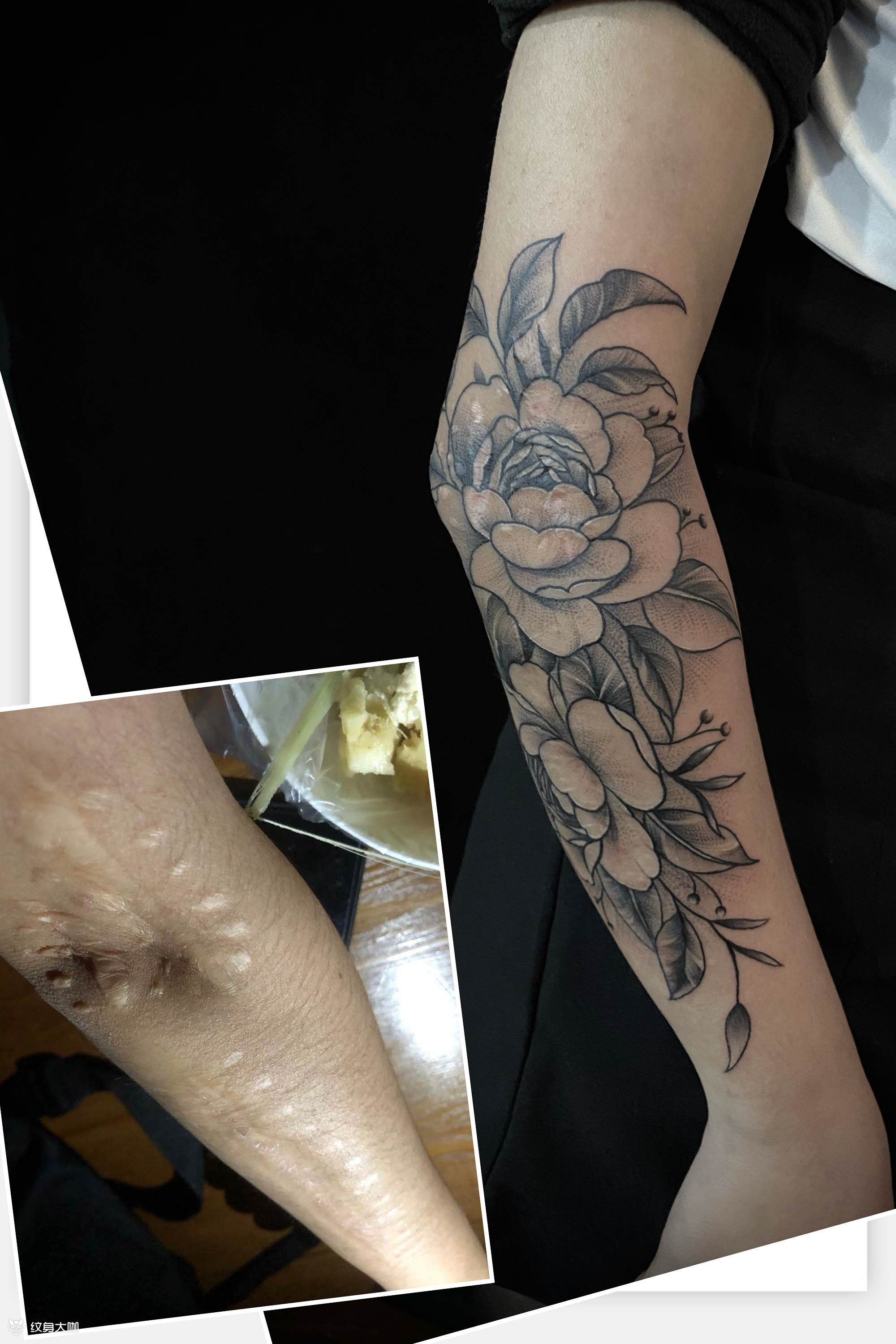 素花遮盖疤痕_纹身图案手稿图片_赵泽涵的纹身作品集