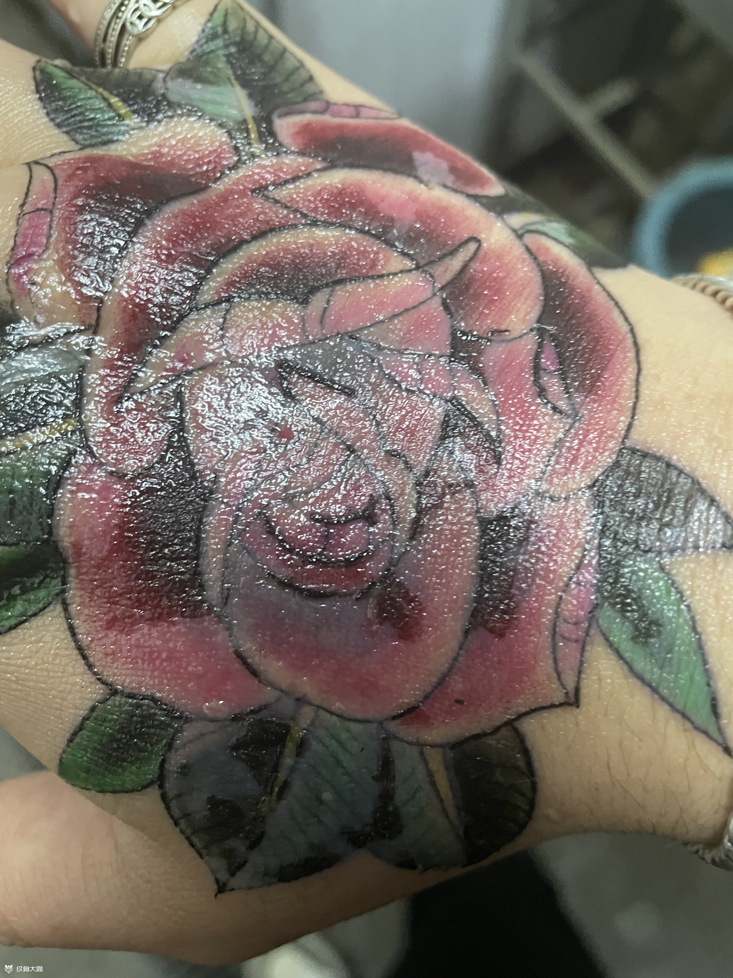 求大神解疑,像我这样的刚掉完痂_纹身吧社区 - 纹身大咖