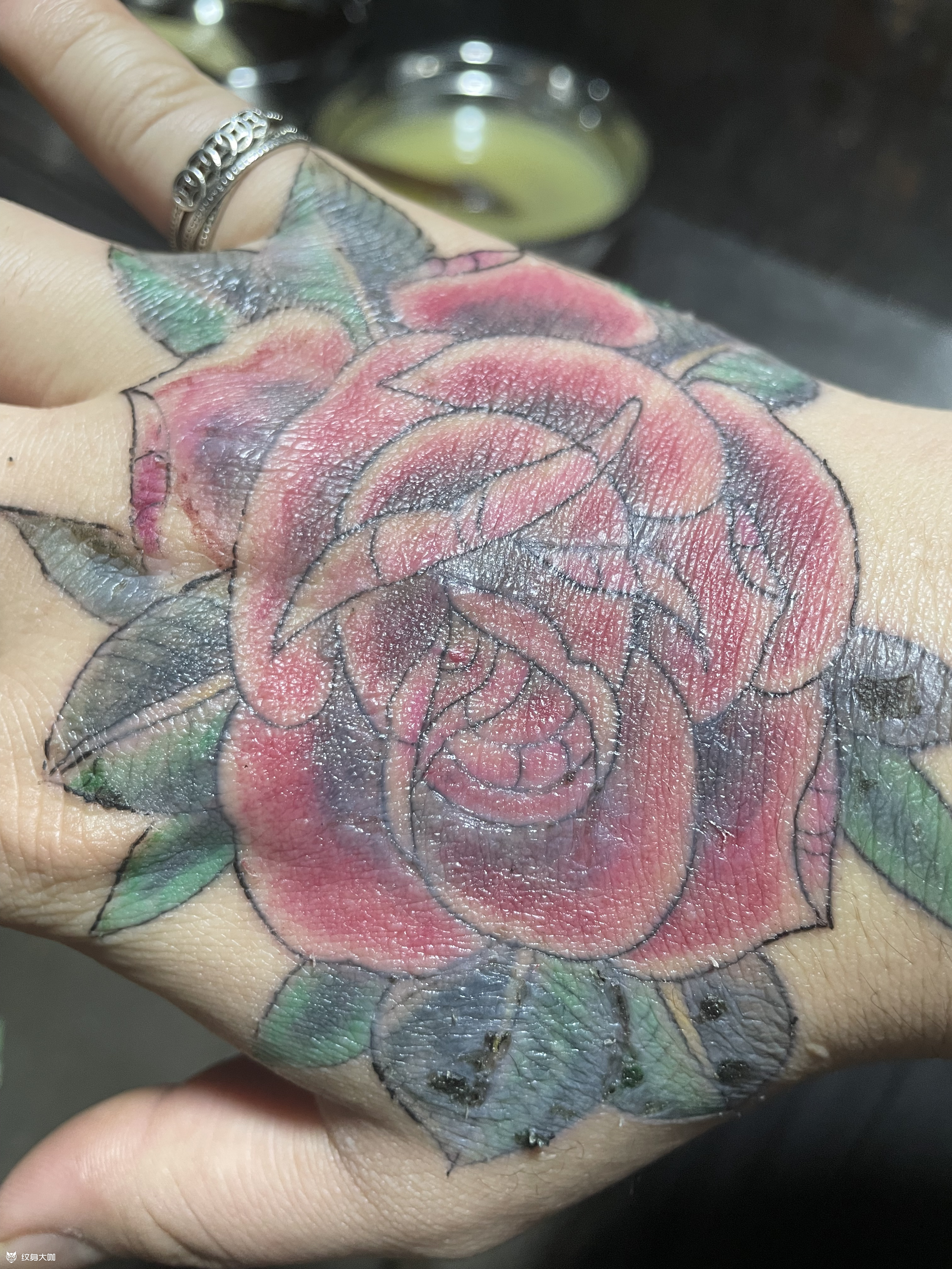 求大神解疑,像我这样的刚掉完痂_纹身吧社区 - 纹身大咖