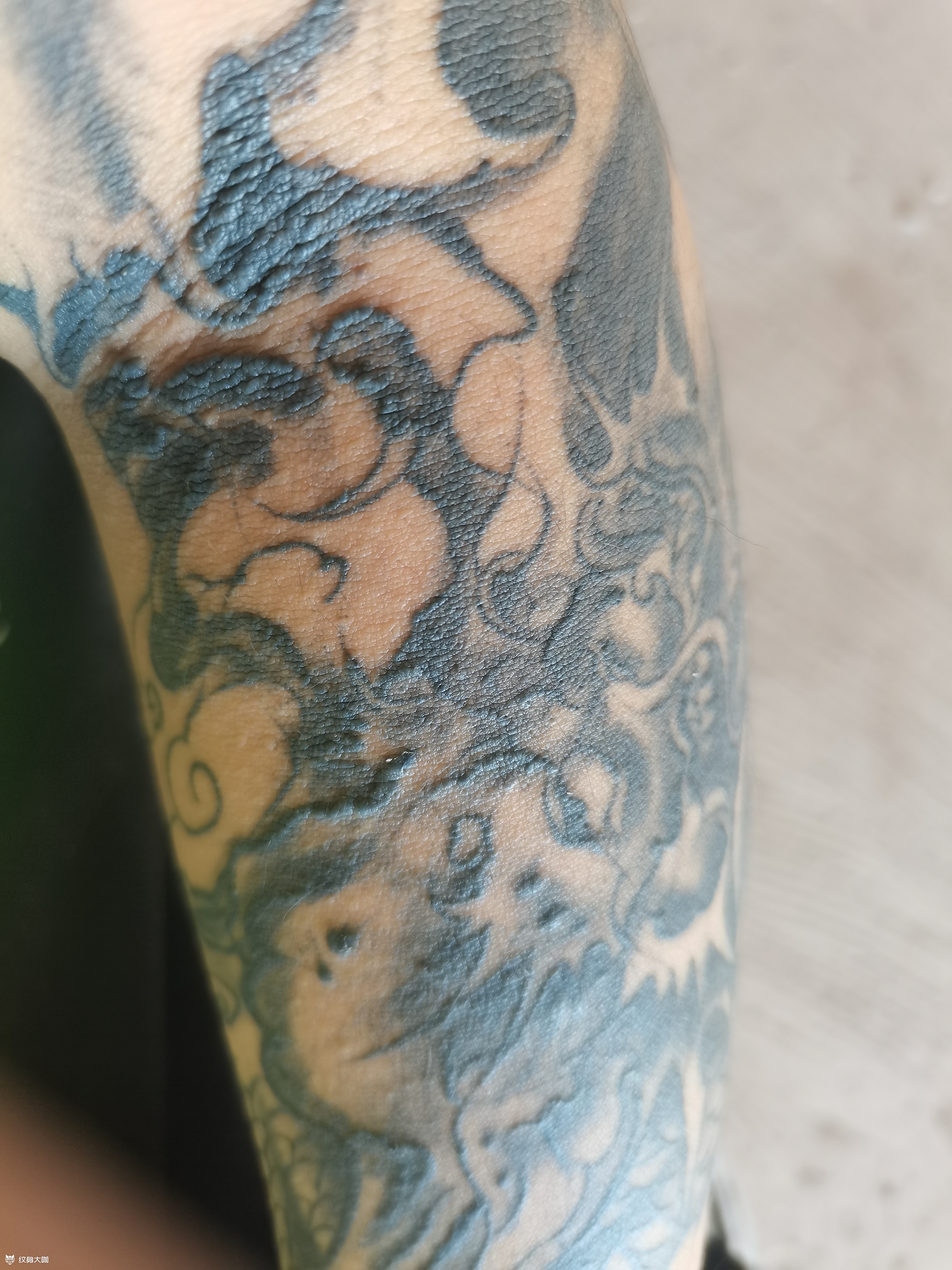 这是排异还是怎么了,几个月复发_纹身吧社区 - 纹身大咖