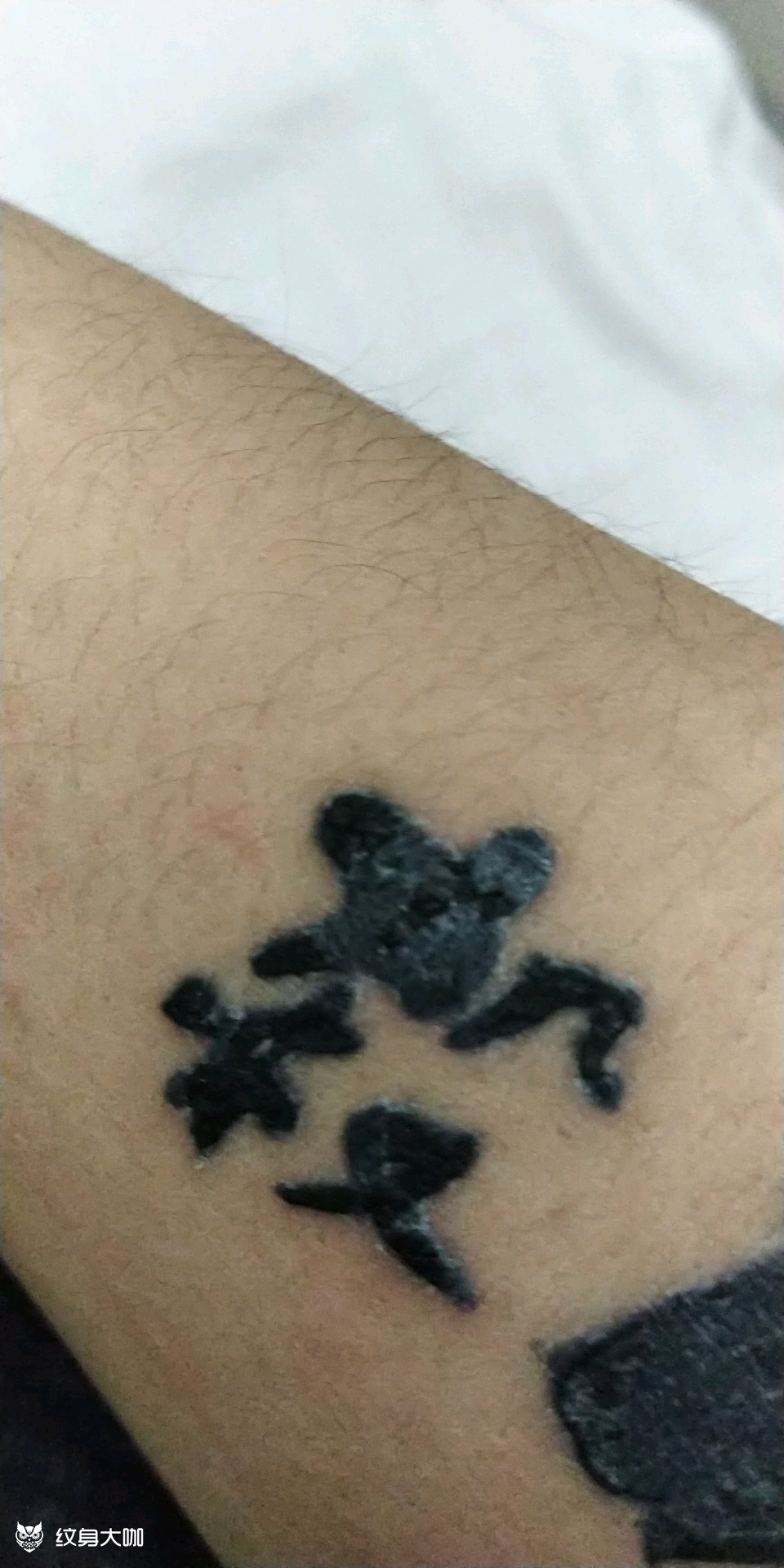 很烦躁,纹身结痂被我扣的掉色了_纹身吧社区 - 纹身大咖