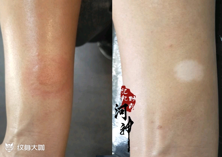 白癜风遮盖_纹身图案手稿图片_河神作品持续更新中的纹身作品集