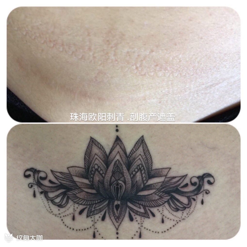剖腹产疤痕遮盖_纹身图案手稿图片_阳丹的纹身作品集