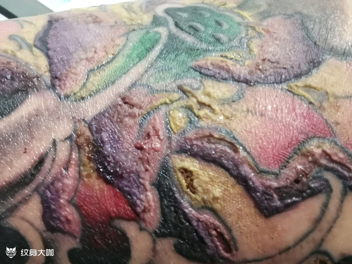 纹完第三天 没法走路 脚脖_纹身吧社区 - 纹身大咖