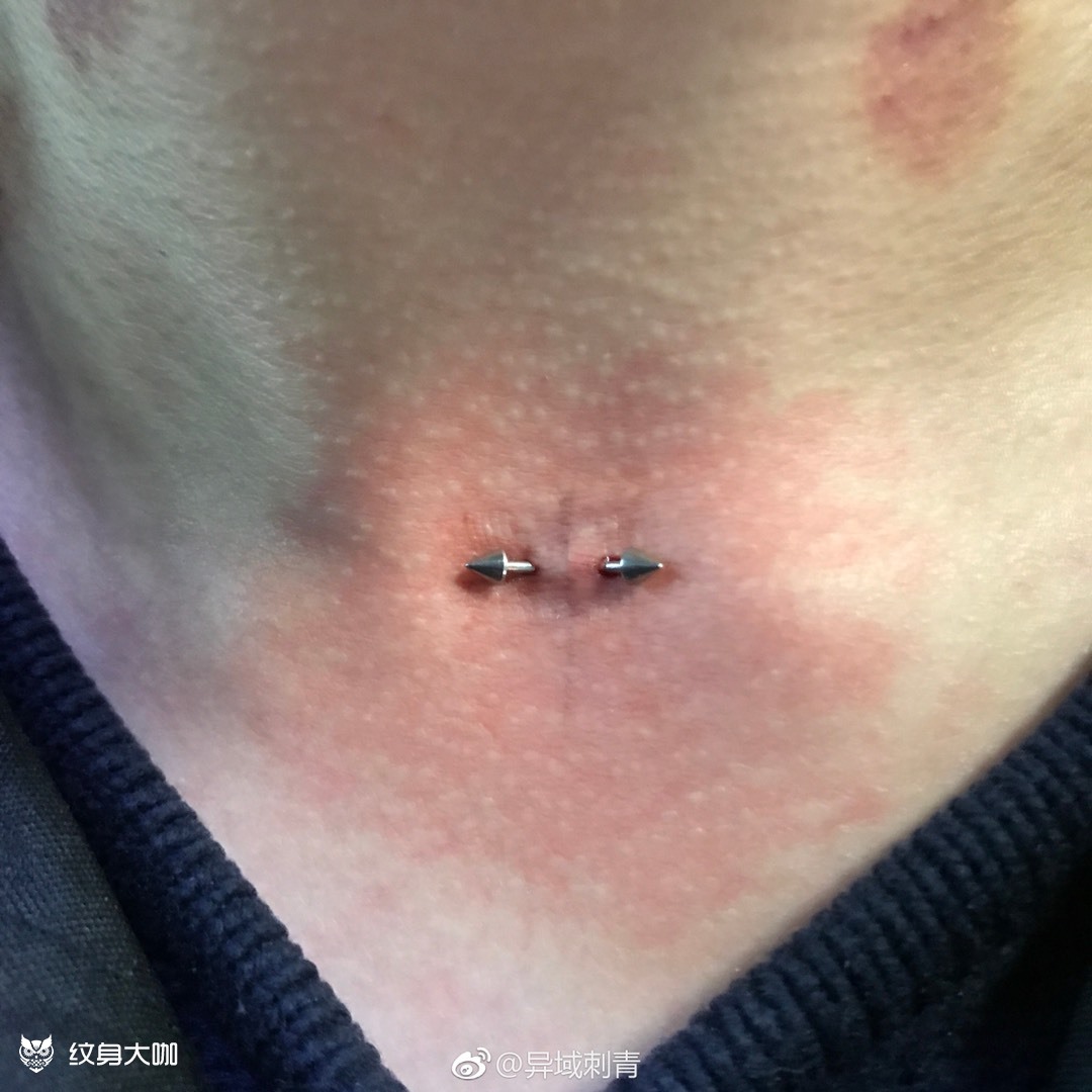 锁骨上窝钉请忽略脖子处印记07