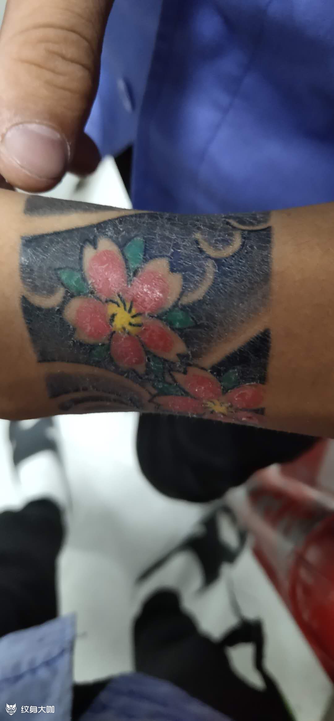 帮忙看下我这是怎么回事,痂皮已_纹身吧社区 - 纹身大咖