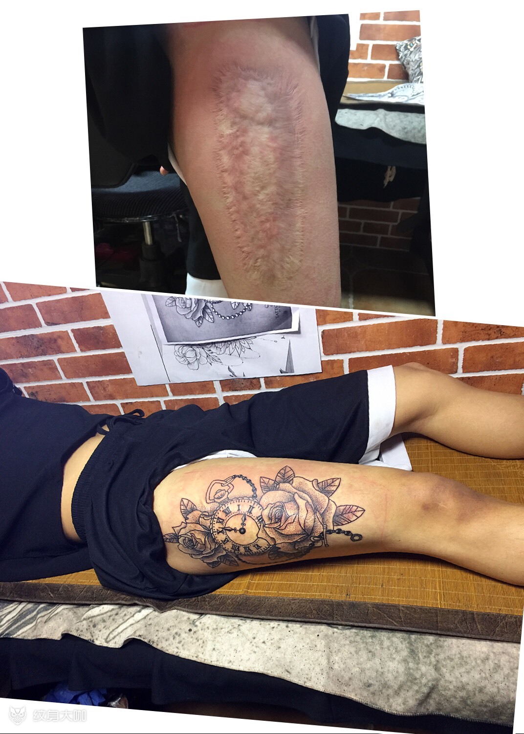 疤痕遮盖_纹身图案手稿图片_聚龙堂小辉的纹身作品集