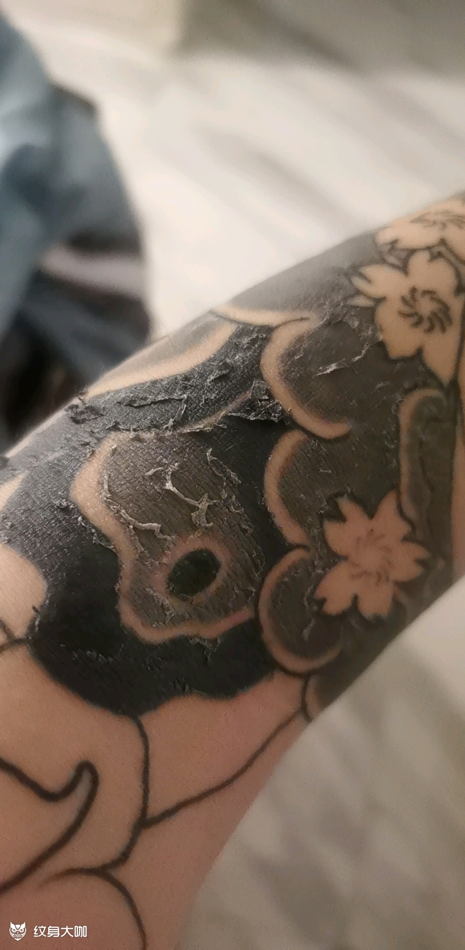 五天爆皮脱皮 痒痒痒_纹身吧社区 - 纹身大咖