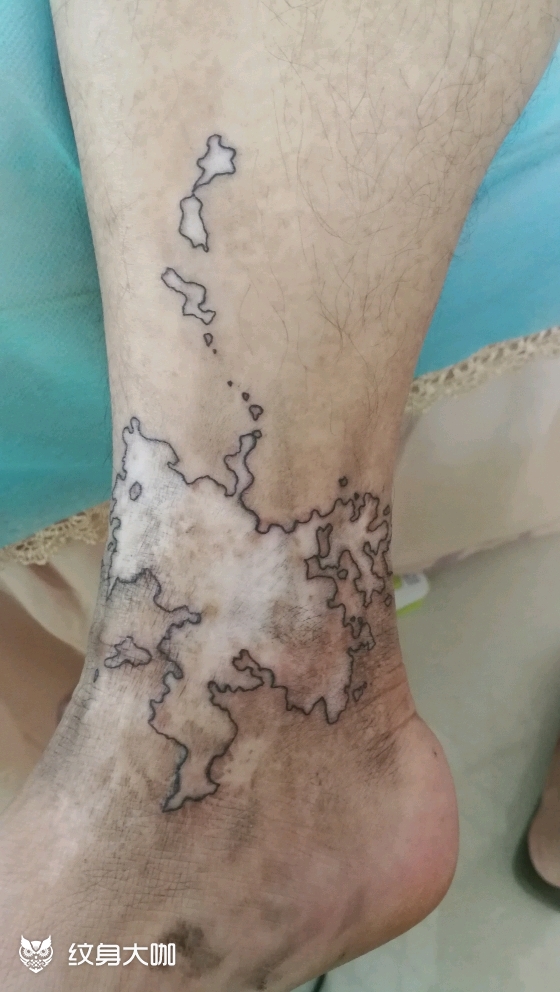 创意遮盖烫伤白斑,创意修饰,_纹身吧社区 - 纹身大咖
