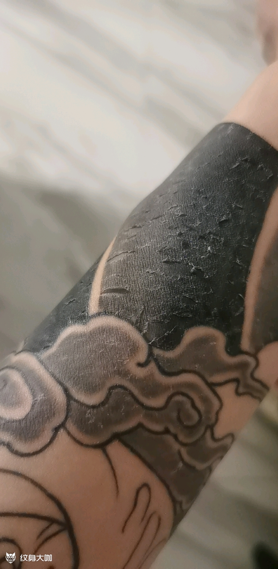 五天爆皮脱皮 痒痒痒_纹身吧社区 - 纹身大咖