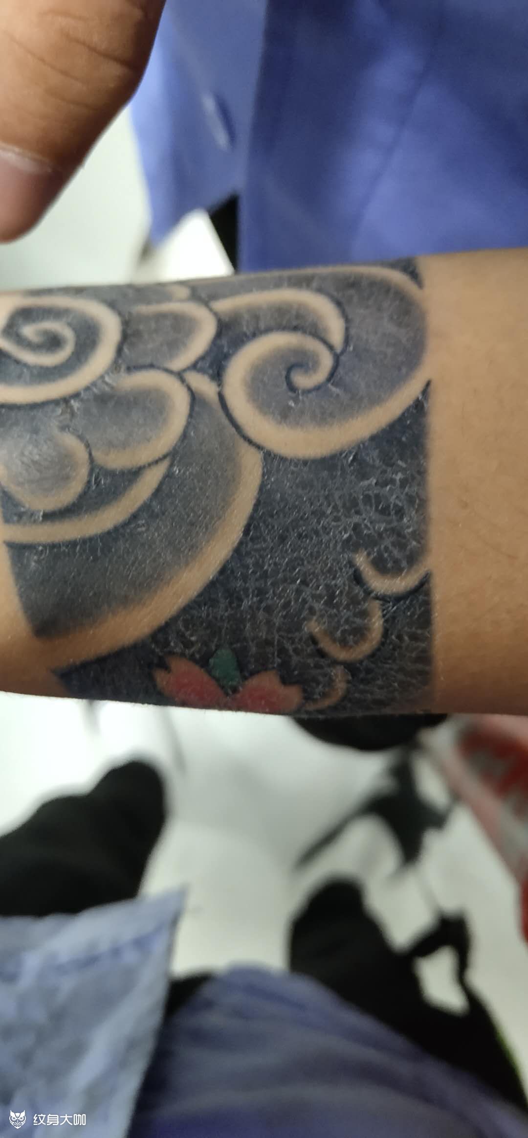 帮忙看下我这是怎么回事,痂皮已_纹身吧社区 - 纹身大咖