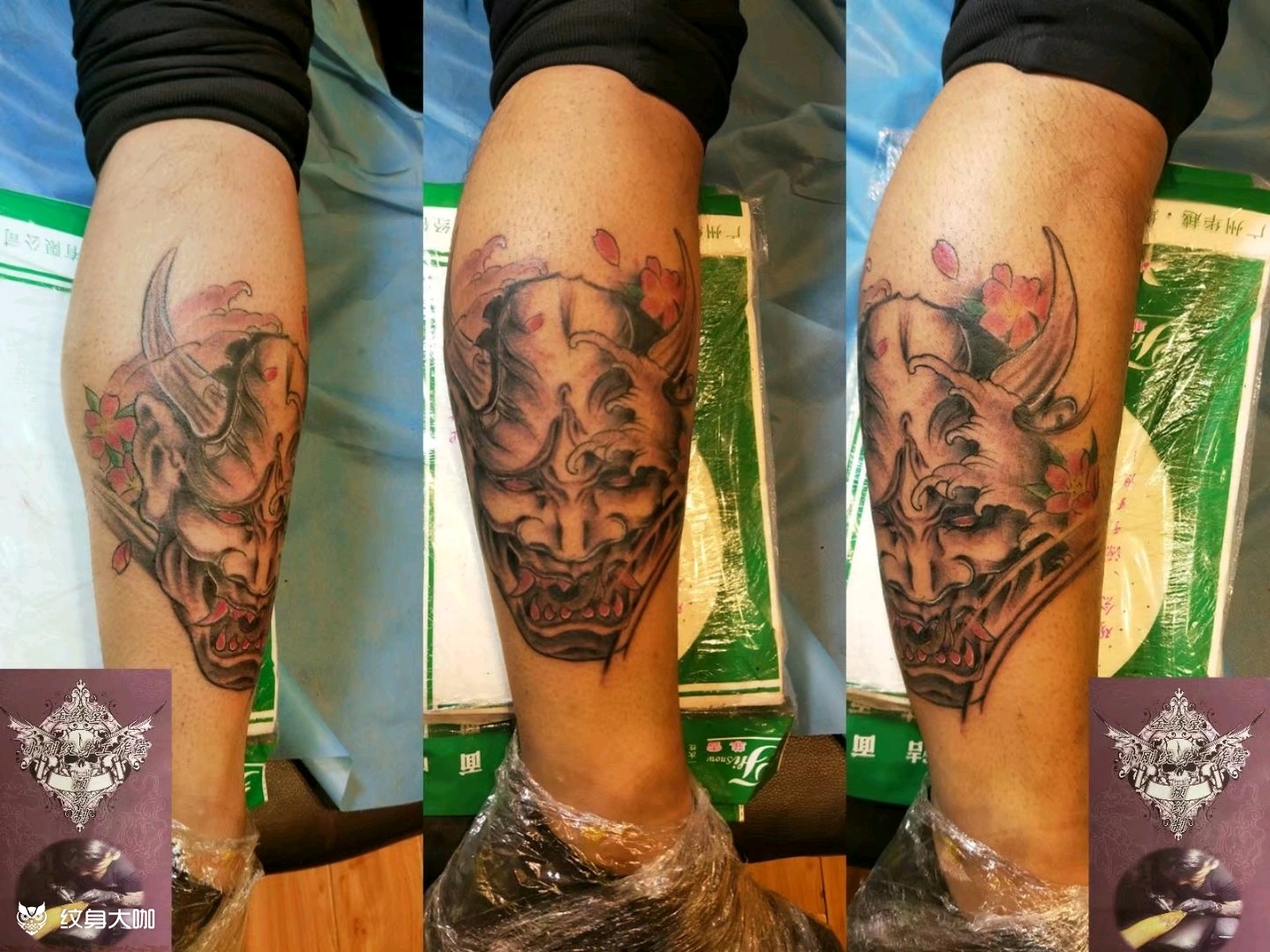 小腿外侧传统班若