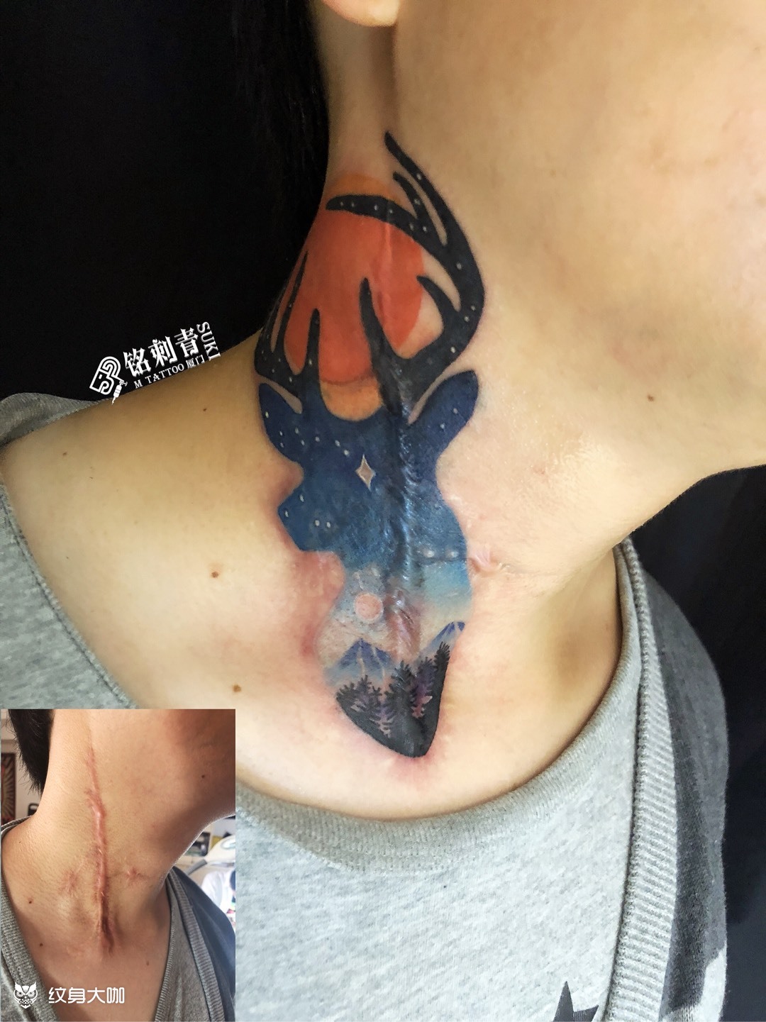 严重疤痕遮盖_纹身图案手稿图片_suki的纹身作品集