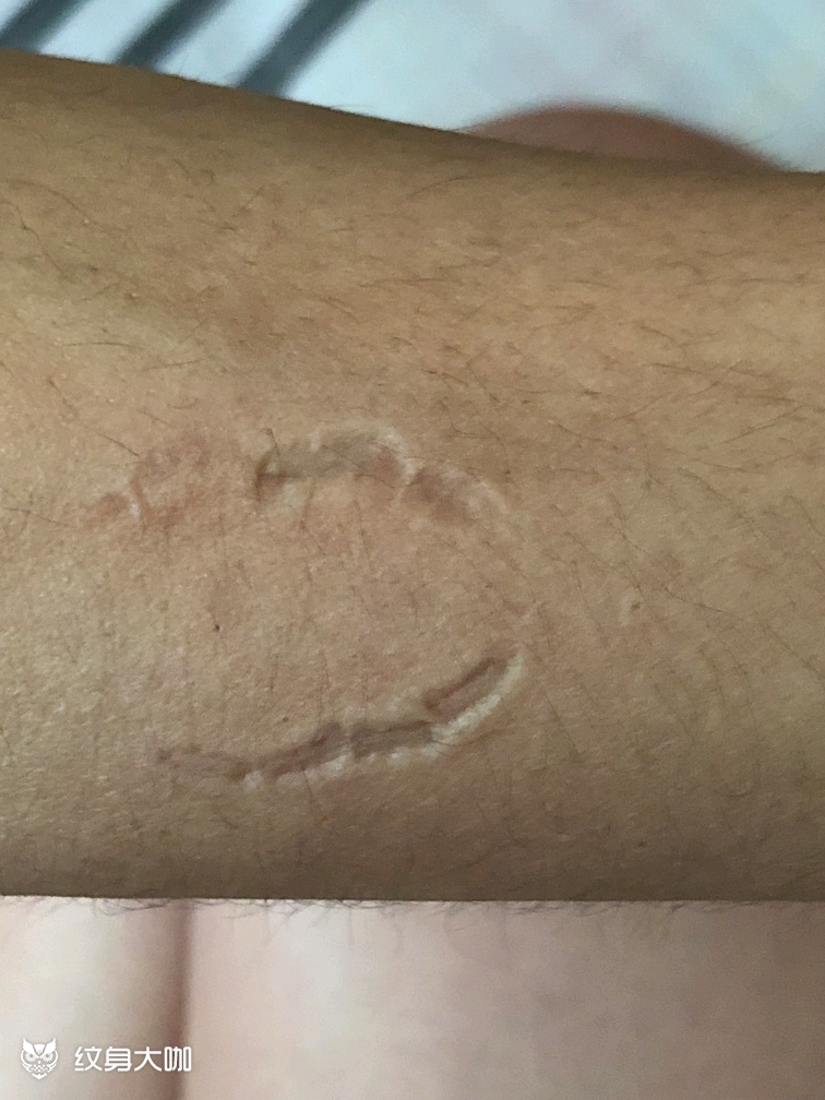 人生七大苦和母亲的牙印因母亲